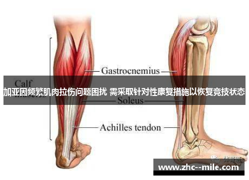 加亚因频繁肌肉拉伤问题困扰 需采取针对性康复措施以恢复竞技状态